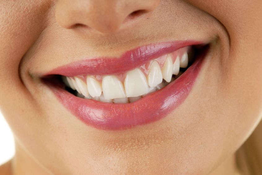 Advantages of Implant Supported Dentures in Marietta, GA