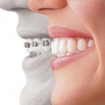 Top Reasons to Get Dental Treatment in St George UT