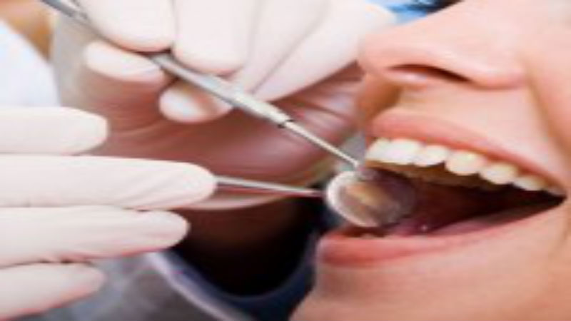 Getting Implants After Periodontal Treatments