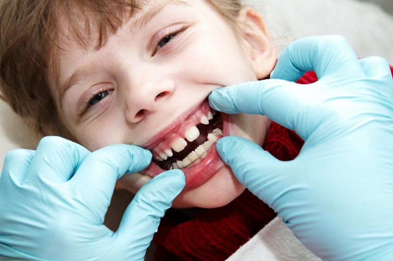 The Great Advantages Of Dental Crowns In Madison, CT