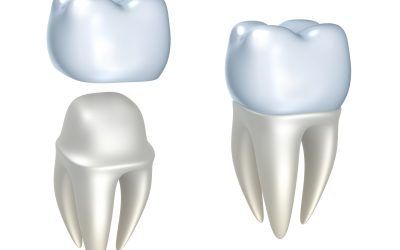 Restore Your Smile with Dental Crowns Madison WI Can Trust for Lasting Results